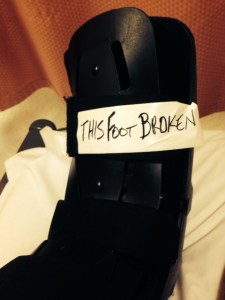Broken foot
